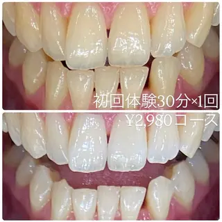 PLATINUM Beauty 横浜店所属・ホワイトニングルーム 横浜店のその他イメージ