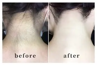 エステティックサロンECOM所属・エステティックサロン ECOMのエステ・リラクイメージ