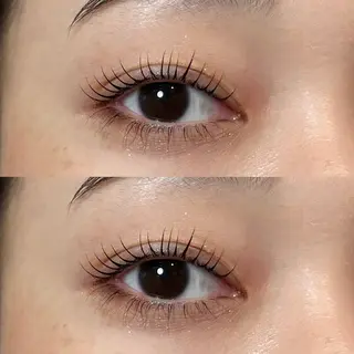 ใใใจใฏใปใใใ ๐๐๐๐๐ ๆ่ฑใฎใใใจใฏใปใใใใใถใคใณ