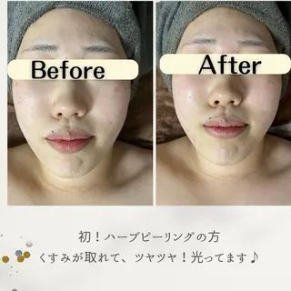 お肌と歯のサロン　Sona Mior所属・藤井 ののみのエステ・リラクイメージ