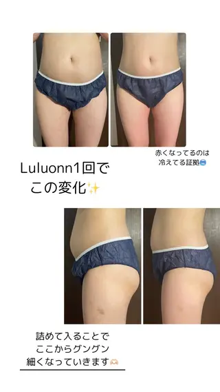 次世代温活痩身❣️ MAYUのエステ・リラクイメージ