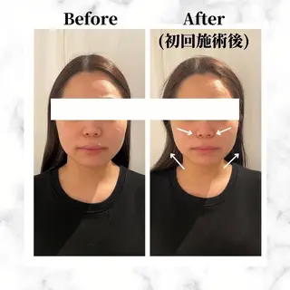 12Dハイフ💗 最強小顔のエステ・リラクイメージ