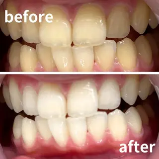 LBSホワイトニング 銀座店💎スタッフ峯のその他イメージ