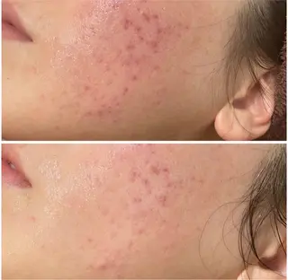 エレファンテブランコ所属・mori yukariのエステ・リラクイメージ