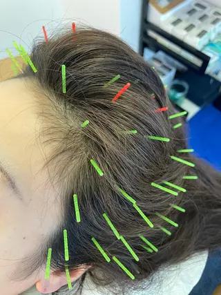 小顔美容鍼専門サロン 渋谷YZのエステ・リラクイメージ