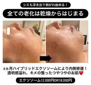 DECIDE L.A.W所属・太田 女久美のエステ・リラクイメージ