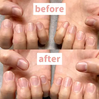 ネイル 小林 ゆりあのネイルデザイン