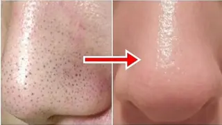 肌ケア＆毛穴洗浄 Cheriのエステ・リラクイメージ