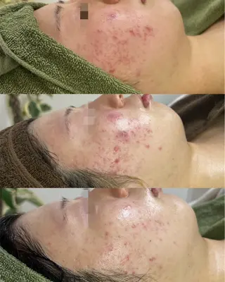 LukeBeauty salonのエステ・リラクイメージ