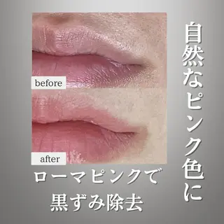 川越ローマピンク 光脱毛＆ワックス脱毛のエステ・リラクイメージ