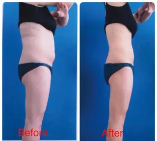 全身痩身✨ キレイサローネ表参道のエステ・リラクイメージ