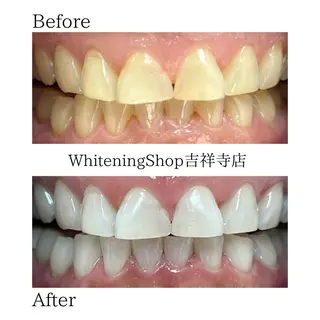 ホワイトニング ショップ吉祥寺店のエステ・リラクイメージ