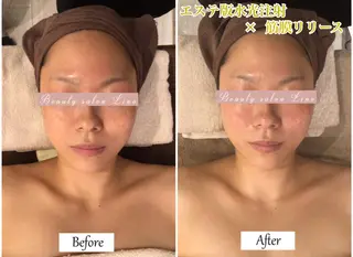 痩身×フェイシャル ブライダル|Linoのエステ・リラクイメージ