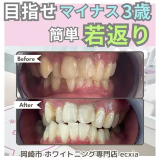 セルフホワイトニング エクシア岡崎店所属・ホワイトニング/脱毛 専門店エクシア岡崎店のその他イメージ