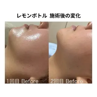 Petit pas所属・プライベートサロン Petit pasのエステ・リラクイメージ