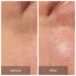 産毛専門店 Bittoのエステ・リラクイメージ