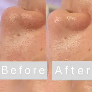 アイラッシュ&エステサロンLinda西宮所属・小顔&毛穴・肌質改善 LINDA西宮 AIのエステ・リラクイメージ