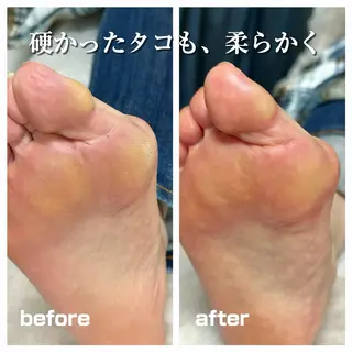 巻き爪フットケアサロンKotori所属・フットケアサロン Kotoriのその他イメージ