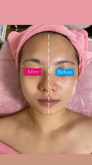 透明感の肌Lino malieのエステ・リラクイメージ