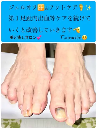 ネイル Tairacchi ﾀｲﾗｯﾁのネイルデザイン