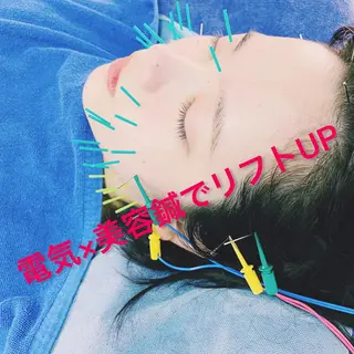 小顔美容鍼専門サロン 渋谷YZのエステ・リラクイメージ