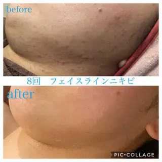 ロング カラー パーマ ヘアアレンジ メンズ キッズ ネイル マツエク・マツパ Ensor Clair所属・EnsorClair 代表 野口真央のエステ・リラクイメージ