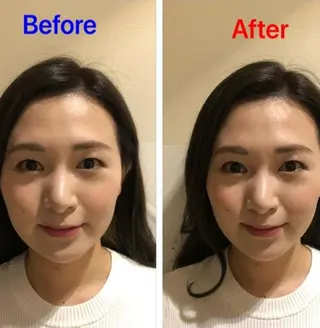 お顔のむくみたるみ 専門☆美容鍼小顔矯正のエステ・リラクイメージ