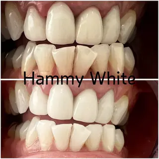 HammyWhite 心斎橋🌈AMIのその他イメージ