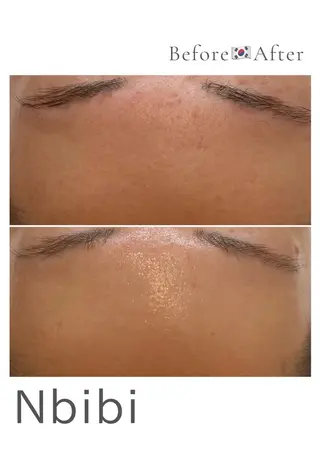 韓国🇰🇷価格 サロン_Nbibiのエステ・リラクイメージ