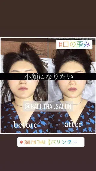 🌈歪み改善🌈 バリンタイ すぎうらのエステ・リラクイメージ