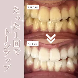 LIBRA自由が丘所属・LIBRA自由が丘 ホワイトニングのその他イメージ