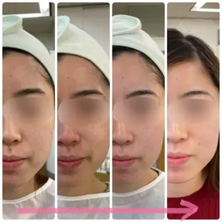 ナリス ビューティステーション DeI'm所属・DeI'mあべの 桶本瑞季のエステ・リラクイメージ