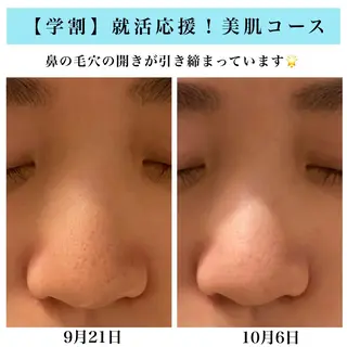 Bellesthe (ベルエステ)のエステ・リラクイメージ