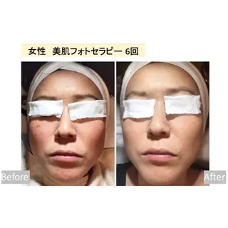 美肌脱毛i所属・美肌脱毛i |泉大津のエステ・リラクイメージ