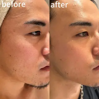 メンズ アピタ千代田橋店 POLA THE BEAUTY所属・エステ ツヤ肌 マッサージ POLAのその他イメージ