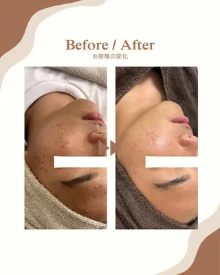 1st｜フェイシャル エステ専門店のエステ・リラクイメージ