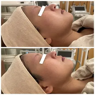 ✨美肌水光✨ アトリエリュバンのエステ・リラクイメージ