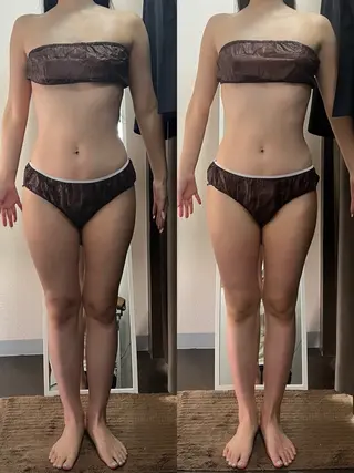 ハイパーナイフ専門店　Salon de COCO所属・Salon de COCOのエステ・リラクイメージ