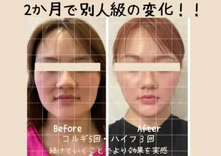 第一印象専門サロン ADISEのエステ・リラクイメージ