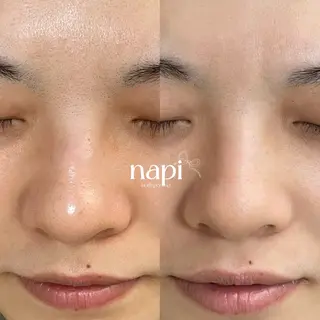 ハーブピーリング 専門店napiのエステ・リラクイメージ
