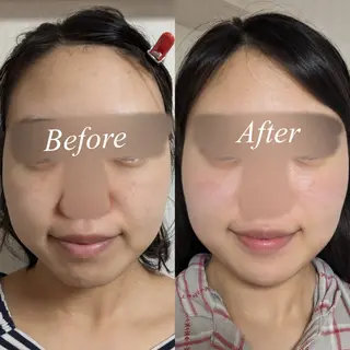 肌質改善サロン🌕 ⠀【ルーナピエナ】のエステ・リラクイメージ