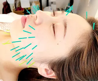 小顔美容鍼専門サロン 渋谷YZのエステ・リラクイメージ