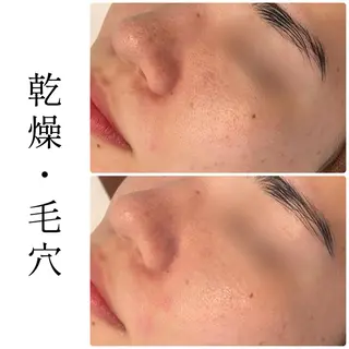 ハーブピーリング専門 BIOEL横浜のエステ・リラクイメージ