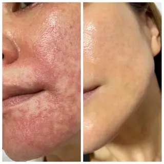 private salon Dea_maris シュガーリング&パーソナルボディケア所属・シミ改善・韓国肌管理 ボディメイク痩身のその他イメージ