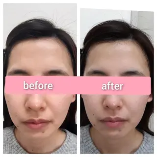 デ・アイム王寺所属・たるみ解消エミリーノ 米田真美子のエステ・リラクイメージ