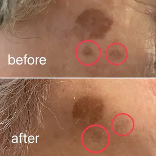 痛くないシミ取り 【荻窪】石橋のヘアスタイル