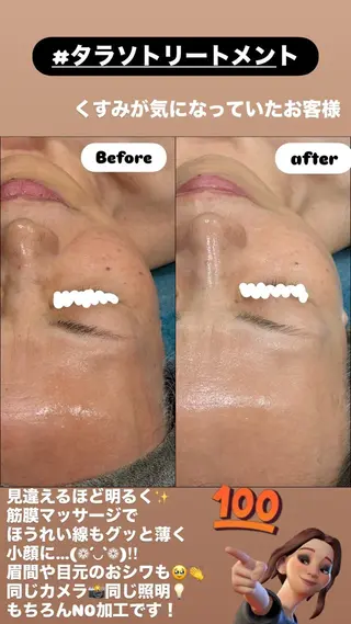 LiZA エステティックサロンのエステ・リラクイメージ