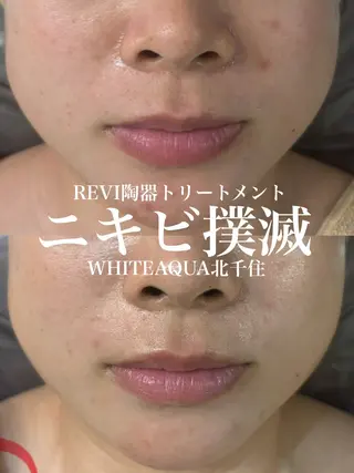 WHITE AQUA 北千住店のエステ・リラクイメージ