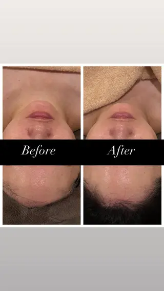 メンズ歓迎👑美肌 ✖️小顔🌿レイのエステ・リラクイメージ