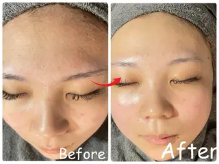 ele"ハーブ ピーリング 専門店のエステ・リラクイメージ